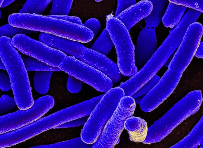 E. coli löst am häufigsten bei Frauen die Entwicklung einer Blasenentzündung aus